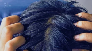 How to Fix Oily Scalp, Weak Hair Roots, and Hair Loss