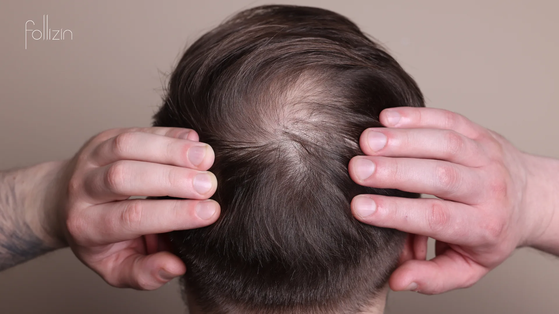 How to Treat Hair Loss and Thinning with Scalp Care