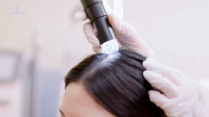 What Is Scalp Fungus Causes, Symptoms, and Treatment